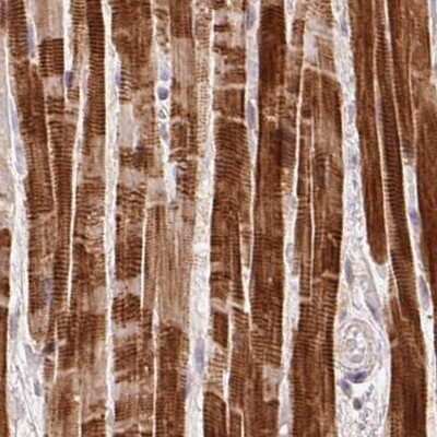 Immunohistochemistry-Paraffin: FAM168B Antibody [NBP2-49343]