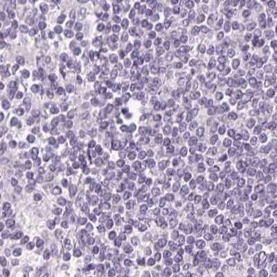 Immunohistochemistry-Paraffin: FAM168B Antibody [NBP2-49343]