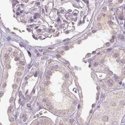 Immunohistochemistry-Paraffin: FAM168B Antibody [NBP2-49343]