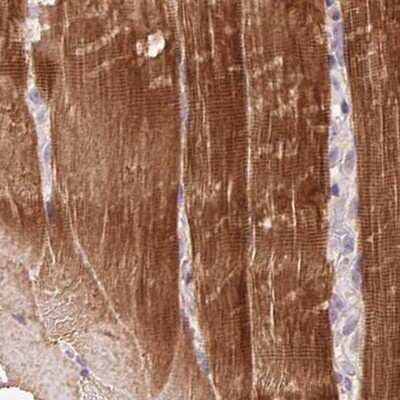 Immunohistochemistry-Paraffin: FAM168B Antibody [NBP2-49343]