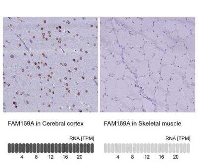 Immunohistochemistry-Paraffin: FAM169A Antibody [NBP1-93616]