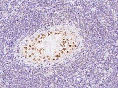 Immunohistochemistry-Paraffin: FAM169A Antibody [NBP3-06242]