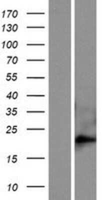 Western Blot: FAM169B Overexpression Lysate [NBP2-04848]