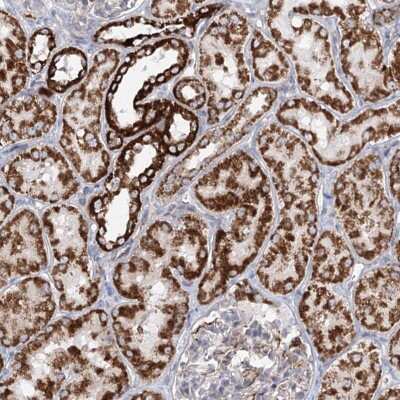 Immunohistochemistry: FAM170A Antibody [NBP2-32706]
