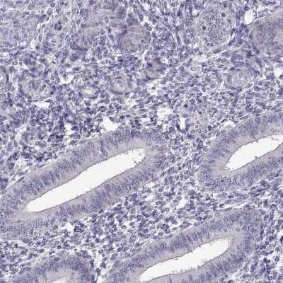 Immunohistochemistry-Paraffin: FAM170A Antibody [NBP2-32706]