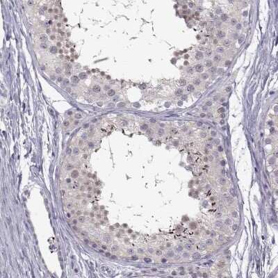 Immunohistochemistry-Paraffin: FAM170A Antibody [NBP2-32706]