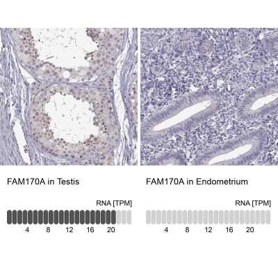 Immunohistochemistry-Paraffin: FAM170A Antibody [NBP2-32706]