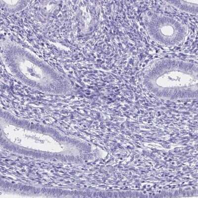 Immunohistochemistry-Paraffin: FAM170A Antibody [NBP2-32707]