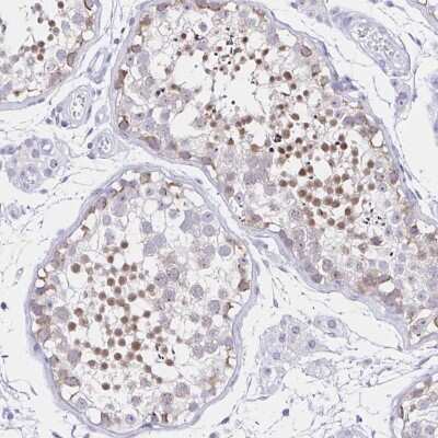 Immunohistochemistry-Paraffin: FAM170A Antibody [NBP2-32707]