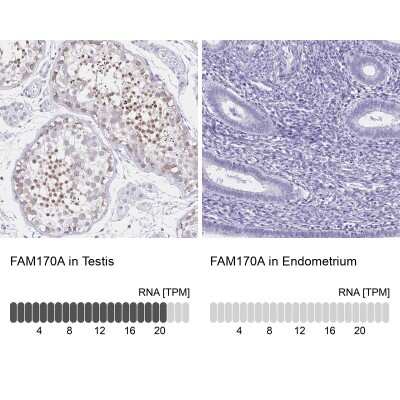Immunohistochemistry-Paraffin: FAM170A Antibody [NBP2-32707]