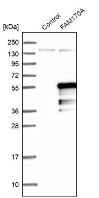 Western Blot: FAM170A Antibody [NBP2-32706]