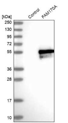 Western Blot: FAM170A Antibody [NBP2-32707]