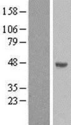 Western Blot: FAM170A Overexpression Lysate [NBP2-04802]