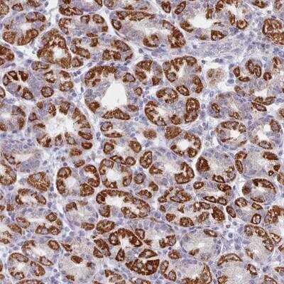 Immunohistochemistry-Paraffin: FAM170b Antibody [NBP2-13986]