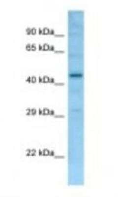 Western Blot: FAM170b Antibody [NBP1-98265]