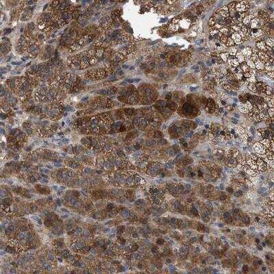 Immunohistochemistry-Paraffin: FAM171A2 Antibody [NBP1-93482]