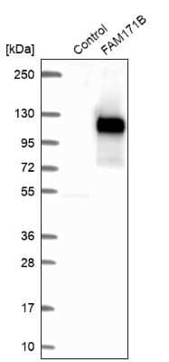 Western Blot: FAM171B Antibody [NBP1-93846]