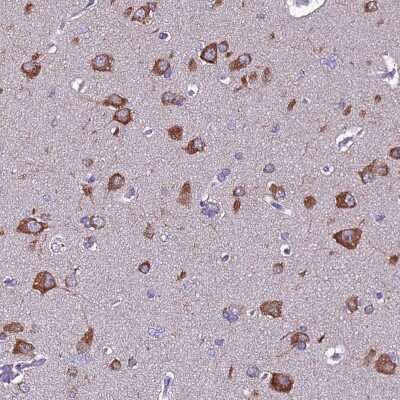Immunohistochemistry-Paraffin: FAM173A Antibody [NBP1-94122]