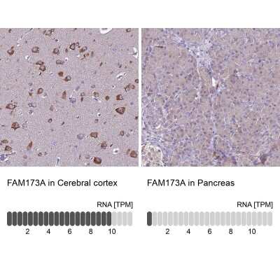 Immunohistochemistry-Paraffin: FAM173A Antibody [NBP1-94122]