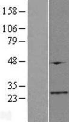 Western Blot: FAM173B Overexpression Lysate [NBL1-10498]