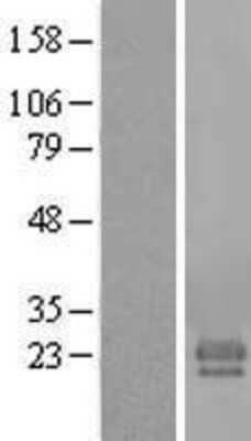 Western Blot: FAM174A Overexpression Lysate [NBL1-10499]