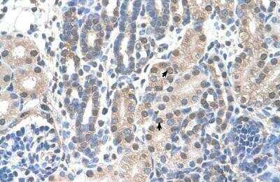 Immunohistochemistry-Paraffin: FAM174B Antibody [NBP1-91565]