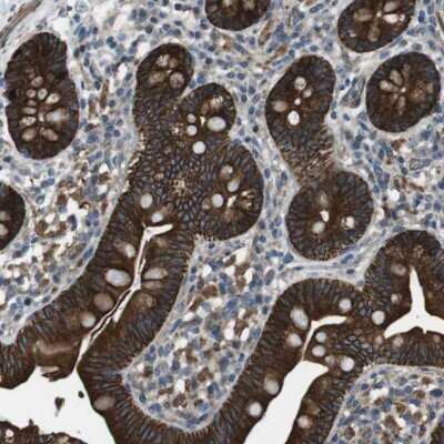 Immunohistochemistry-Paraffin: FAM174B Antibody [NBP2-33873]