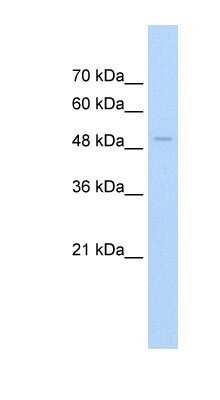 Western Blot: FAM174B Antibody [NBP1-91564]