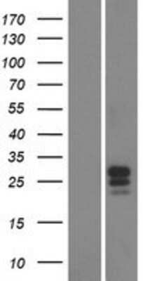 Western Blot: FAM174B Overexpression Lysate [NBP2-04502]