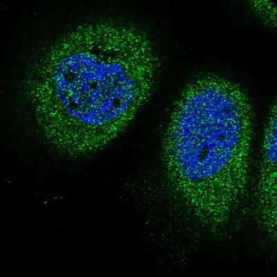 Immunocytochemistry/ Immunofluorescence: FAM176B Antibody [NBP2-31991]