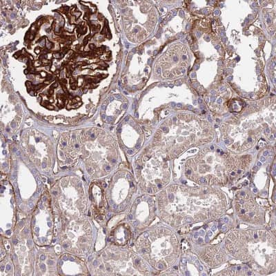 Immunohistochemistry-Paraffin: FAM176B Antibody [NBP2-31991]