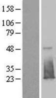 Western Blot: FAM176B Overexpression Lysate [NBL1-10503]