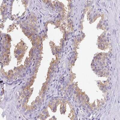 Immunohistochemistry: FAM177A1 Antibody [NBP2-33293]