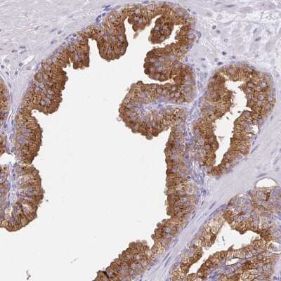 Immunohistochemistry: FAM177A1 Antibody [NBP2-33294]