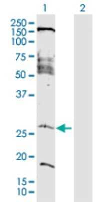 Western Blot: FAM177A1 Antibody [H00283635-D01P]