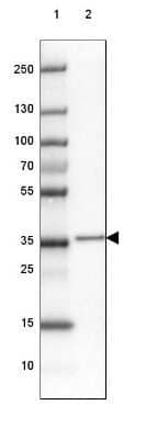 Western Blot: FAM177A1 Antibody [NBP2-33294]