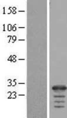 Western Blot: FAM177A1 Overexpression Lysate [NBL1-10504]