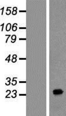 Western Blot: FAM177A1 Overexpression Lysate [NBP2-05123]