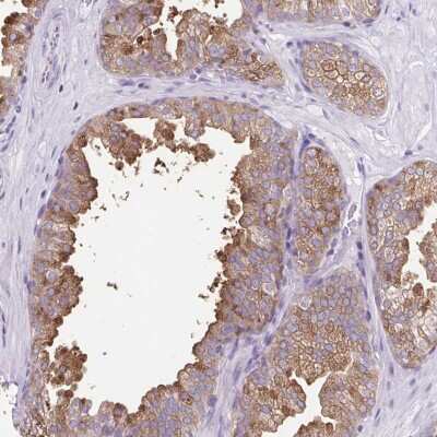 Immunohistochemistry-Paraffin: FAM177B Antibody [NBP2-38015]