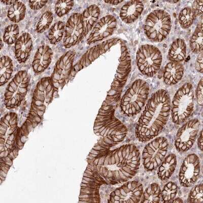 Immunohistochemistry: FAM179A Antibody [NBP2-32687]