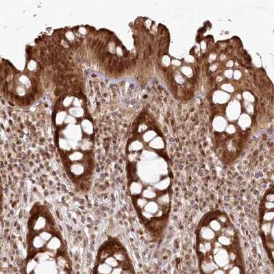 Immunohistochemistry-Paraffin: FAM179A Antibody [NBP1-93765]