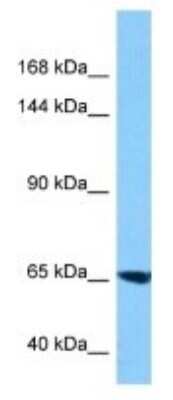 Western Blot: FAM179A Antibody [NBP3-10984]