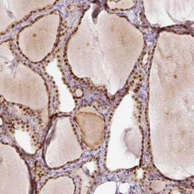 Immunohistochemistry-Paraffin: FAM179B Antibody [NBP2-30676]