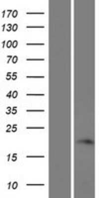 Western Blot: FAM180A Overexpression Lysate [NBP2-04532]