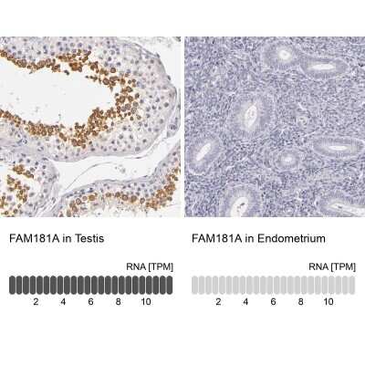 Immunohistochemistry-Paraffin: FAM181A Antibody [NBP1-90730]