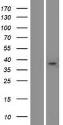 Western Blot: FAM181A Overexpression Lysate [NBP2-05655]