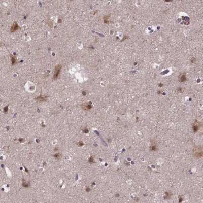 Immunohistochemistry-Paraffin: FAM181B Antibody [NBP2-38096]