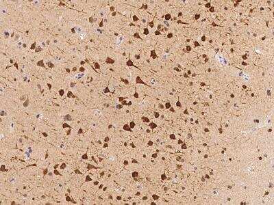 Immunohistochemistry-Paraffin: FAM181B Antibody [NBP3-06306]