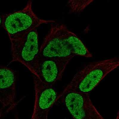 Immunocytochemistry/ Immunofluorescence: FAM182B Antibody [NBP2-33590]