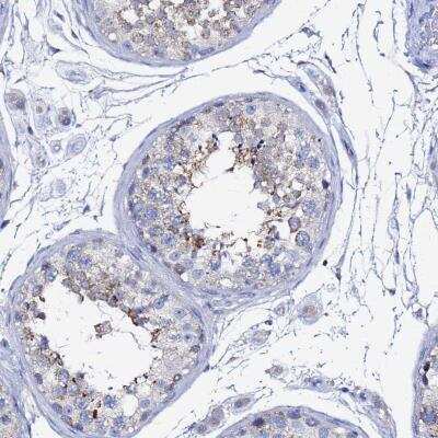 Immunohistochemistry: FAM183A Antibody [NBP2-33391]